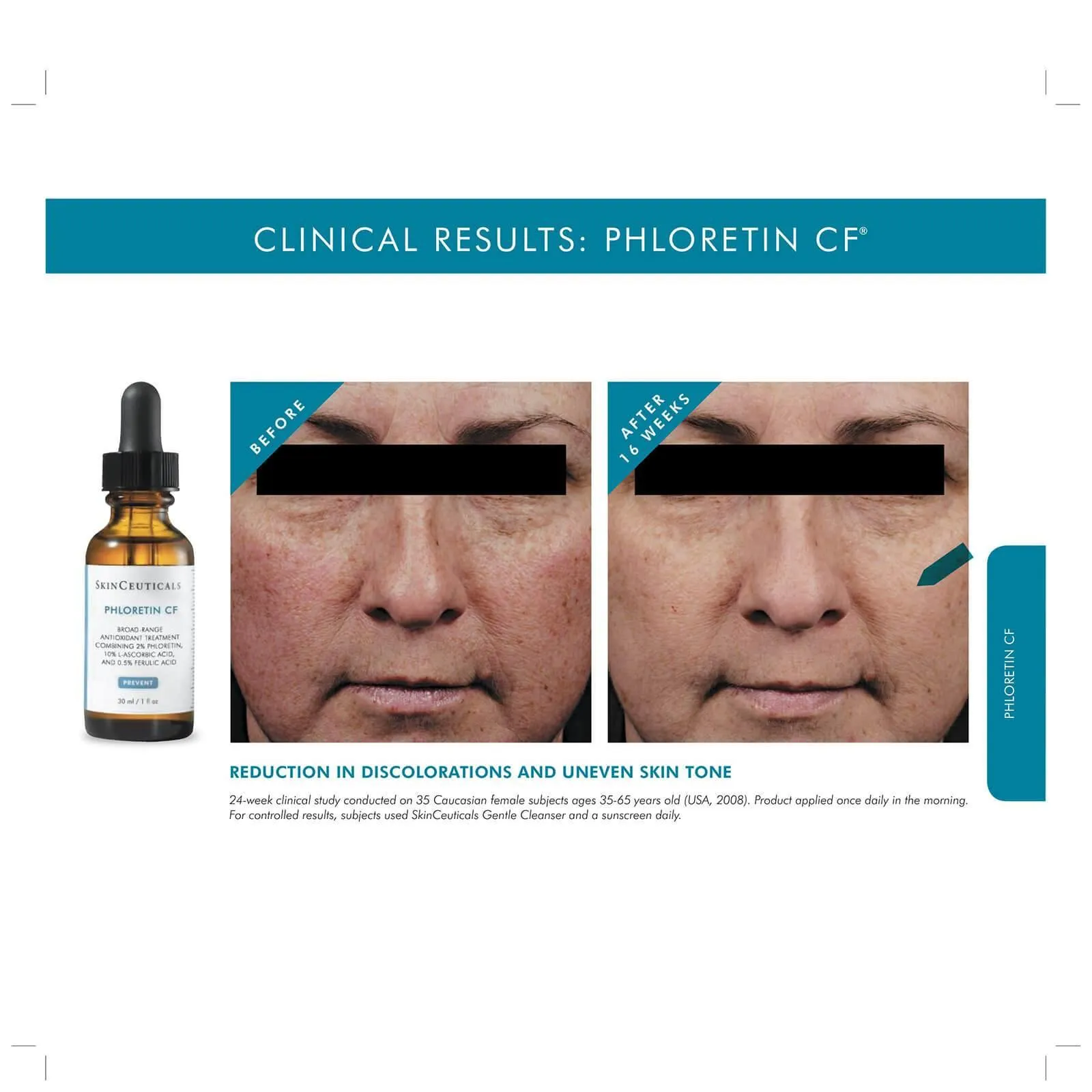 SkinCeuticals | Phloretin CF Serum (30ml)